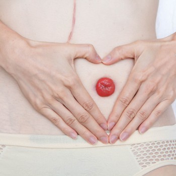 IMANI HOME CARE - STOMA CARE