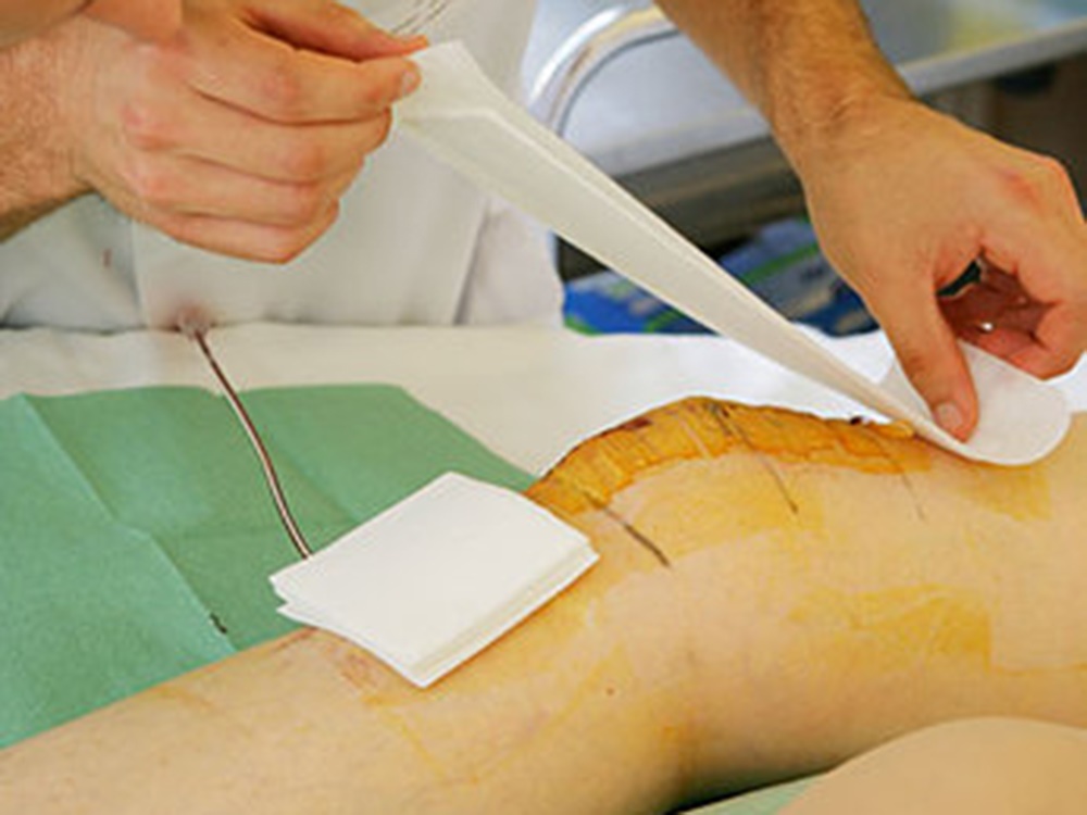 advanced wound 8